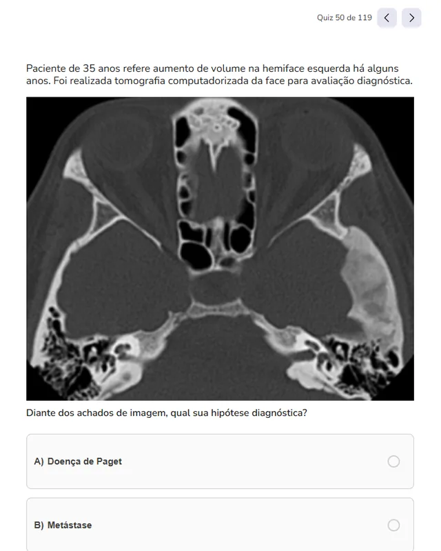 Tela de Quizzes no Whitebook web: Quizzes